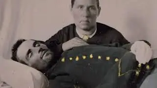 Rare Civil War Postmortem Photographs of Dead Soldiers 1860's