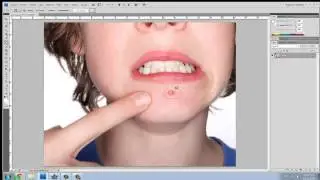Tutorial- Como quitar una imperfección (grano) con PhotoShop! :3