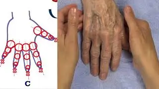 Therapeutische handmassage