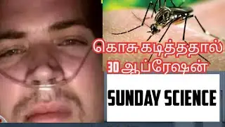 Sunday science - கொசு கடி- 30 ஆப்ரேஷன்.