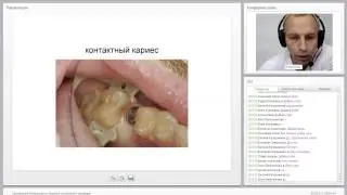 2016 09 13  Применение микроскопа в практике стоматолога терапевта  822440
