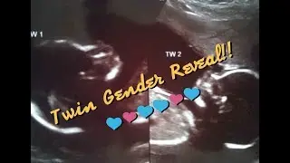 Twin Gender Reveal! (Girls, Boys or both?)