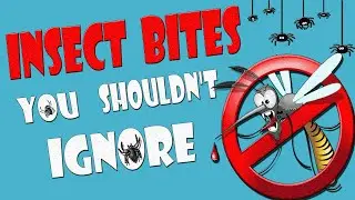 Insect bites you shouldn't ignore