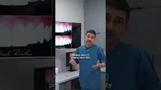 Czy wybielanie zębów jest zdrowe?
