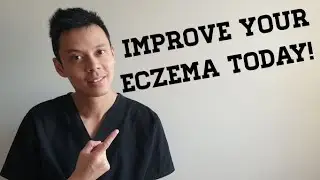 How To Treat Eczema - 10 Best MUST KNOW Tips!