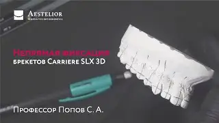 С. А. Попов: Непрямая фиксация брекетов Carriere SLX 3D на гипсовой модели. Изготовление каппы.