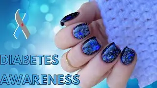 World Diabetes Day Awareness Manicure | Julie's Diabetes Duo by Triple D