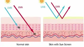Effects of Sun Exposure