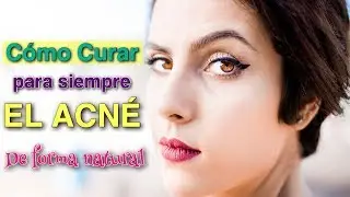 👍 Cómo CURAR el ACNÉ 😱 de forma NATURAL [4 SECRETOS]