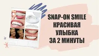 😀 Виниры для зубов цена москва купить ⭐ Керамические виниры как устанавливаются ⚡