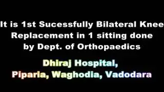 Total Knee Replacement for Osteoarthritis knee pain