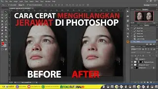 Cara mudah dan cepat menghilangkan jerawat dengan photoshop | tutorial89