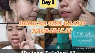 How to Remove Pimples Using Maxipeel | (1-30) #HowtoRemovePimples