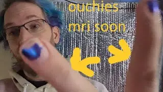 updates on messed up hand and new pc