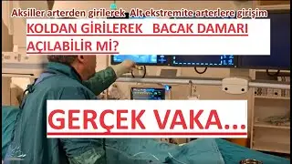 KolDan BaCAK DAMARI AÇILIRMI GERÇEK VAKA..