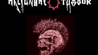 Malignant Tumour - Infernor