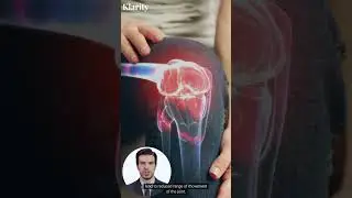 What Is A Joint Effusion? 