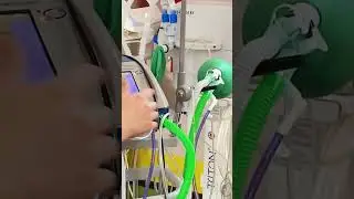 Практические советы по эксплуатации и уходу за аппаратом ИВЛ отТатьяны. Кислородная Империя #shorts