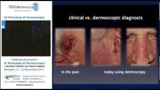 III Workshop - I. Zalaudek - Terapia non chirurgica dei tumori cutanei - part 3-4