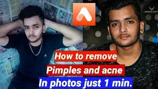 How to remove acne in photos  just 1 minute by atp pictures