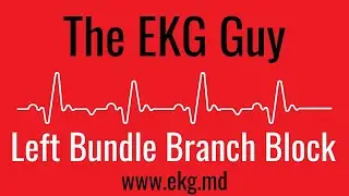 Left Bundle Branch Block (complete) on EKG / ECG l The EKG Guy - www.ekg.md