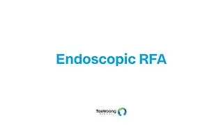 TaeWoong Medical - Endoscopic RFA