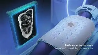 MRI with AIR Touch™ Solution (3D animation by Arcreative 2023)