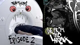 Live from the Larynx EP.2 - Beatboxer vs MRI (Tom Thum)