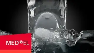 The MED-EL WaterWear Waterproof Cochlear Implant Accessory—MED-EL
