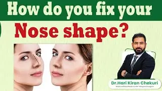 Rhinoplasty Surgery || Nose Reshaping || Dr Harikiran Chekuri || Redefine Plastic Surgery Centre
