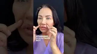 Возвращаем время вспять с помощью подтяжки лица, исходные данные пациентки, этап 1  #фейслифтинг