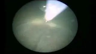 17anastomosis