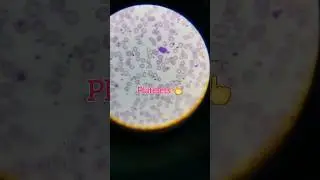 #microscope #cbc #dmlt #sorts #DMLTeducationpoint