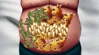 Muddy infested belly worm removal 😑 ASMR TREATMENT ANIMATION # 500