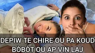 BÒBÒT OU AP VIN LAJ SIW TE CHIRE APRÈ AKOUCHMAN SIW PA KOUD.