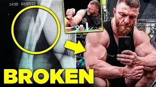 Zurab Tavberidze's Arm Injury - Career Ending?