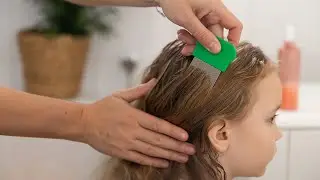 How to treat and prevent head lice