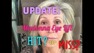 Madonna Eye Lift Update! What Do You Think?