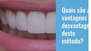 DENTES BRANCOS E SIMÉTRICOS