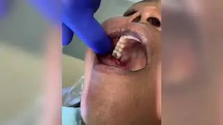 Bioviva dental dressing