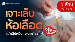 ชัวร์ก่อนแชร์ : เจาะนิ้วห้อเลือดใต้เล็บด้วยคลิปหนีบกระดาษเผาไฟ จริงหรือ ?