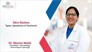 𝐒𝐤𝐢𝐧 𝐑𝐚𝐬𝐡𝐞𝐬 𝑻𝒚𝒑𝒆𝒔, 𝑺𝒚𝒎𝒑𝒕𝒐𝒎𝒔 & 𝑻𝒓𝒆𝒂𝒕𝒎𝒆𝒏𝒕 | Dr. Meenu Malik |  Aakash Healthcare