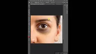 How to Fix Your Dark Circle Problem in Photoshop #photoshoptutorial #shorts