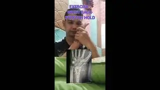 Wrist Fracture Therapy Exercises