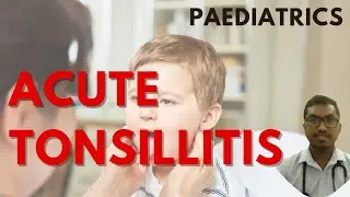 Acute Tonsillitis and Quincy | Paediatrics | Pathophysiology, Clinical Features and Management