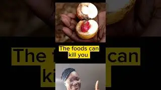 Bizarre Crazy facts #youtubeshorts #shorts