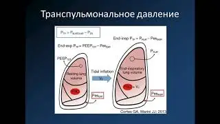 Монтиторинг транспульмонльн давления при ОРДС Полупан АА
