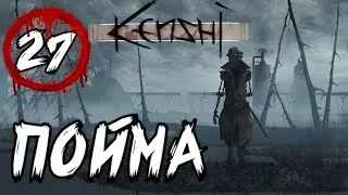 Ожог из Поймы [ 