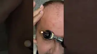Cranial Nerve Exam Gone Wrong #asmr #asmcommunity #cranialnerveexam #short