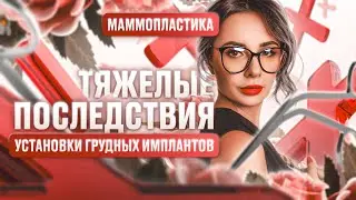 Тяжелые последствия установки грудных имплантов. Маммопластика.